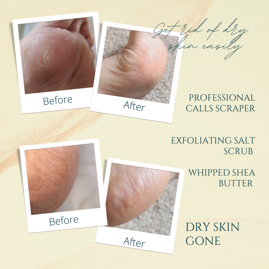 Skin Care Bundle with Large Tray
